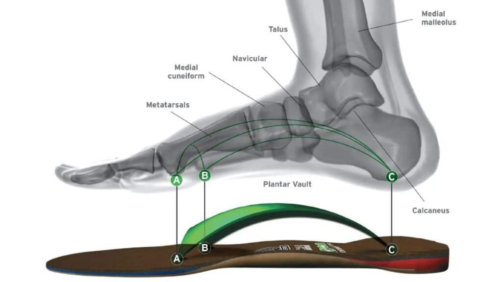 Metatarsal Arch Support